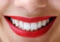 Ką valgyti ir gerti, kad dantys būtų gražūs ir sveiki?